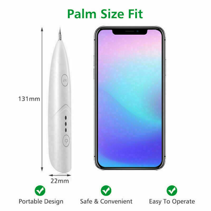 Ion Laser Freckle Skin Mole Dark Spot Remover Face Wart Tag Tattoo Removal Pen Ion Laser Freckle Skin Mole Dark Spot Remover Face Wart Tag Tattoo Removal Pen